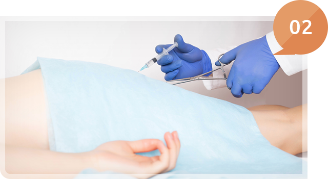 切らずに治療できる痔のジオン注射に対応